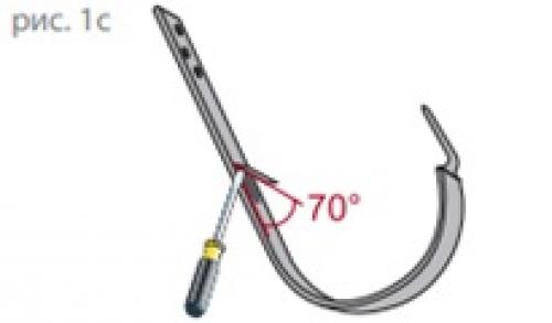 Схема монтажа водосточной системы. Монтаж водосточной системы - инструкция 10 Схема монтажа водосточной системы. Монтаж водосточной системы - инструкция 10